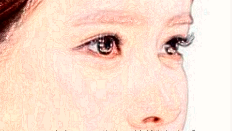 2024鞍鼻矯正價格表_鞍鼻矯正需要住院嗎