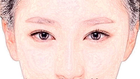 玻尿酸豐太陽穴危險(xiǎn)嗎_2024玻尿酸豐太陽穴價(jià)格表