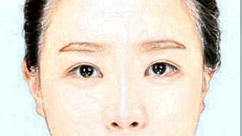 祛斑小妙招(9月更新)_2024祛斑收費(fèi)價目表