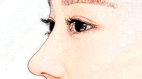 墊鼻失敗修復的價格表_墊鼻失敗修復步驟