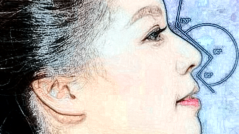 鼻翼縮小價(jià)格表_鼻翼縮小術(shù)后還會(huì)反彈嗎