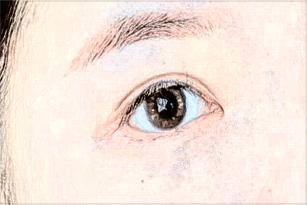 2024上瞼提肌的價格表(10月更新)_上瞼提肌后遺癥