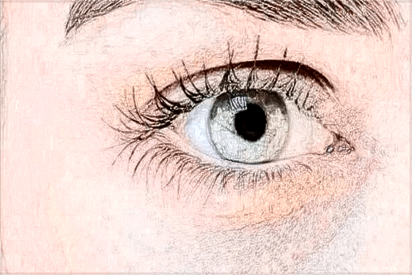 2024開(kāi)眼角手術(shù)價(jià)格表(10月更新)_開(kāi)眼角會(huì)留疤嗎