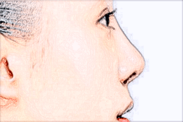 上海薇琳熱瑪吉怎么樣?2024上海薇琳熱瑪吉價(jià)格表