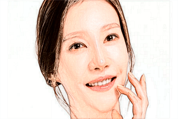 2024深圳嘉美開眼角價目表_附開眼角案例