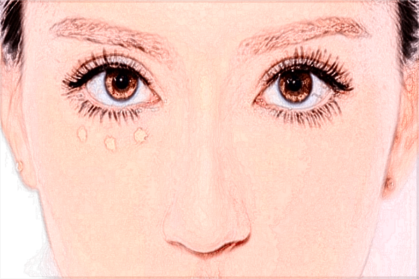 上海薇琳鼻子整形醫(yī)生哪個好?附收費價格表