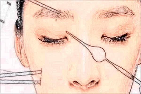 南醫(yī)大友誼面部年輕化收費價格表(價目表)一覽