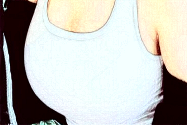 深圳嘉美假體隆胸怎么樣_2024假體隆胸價目表