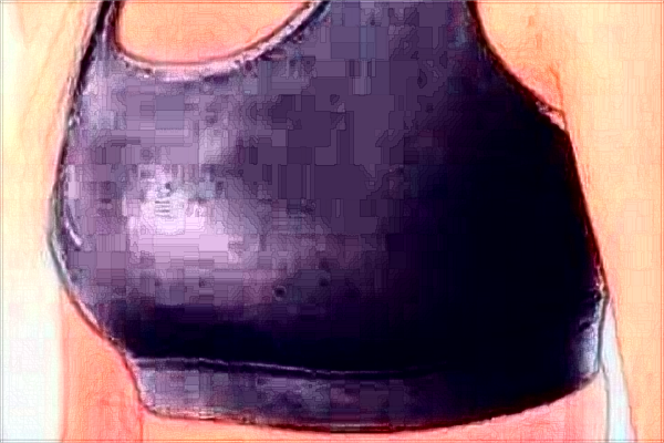 去副乳價目表公布_去副乳會留疤嗎