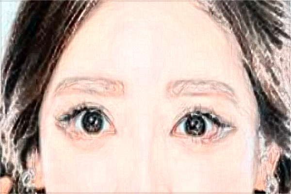 割雙眼皮和埋線哪個好?割雙眼皮和去眼袋哪個風險大?