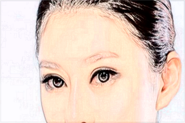 割雙眼皮和埋線哪個好?割雙眼皮和去眼袋哪個風險大?