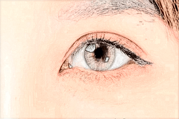 2024深圳藝星去眼袋價格表(10月)_祛眼袋的手術(shù)方法