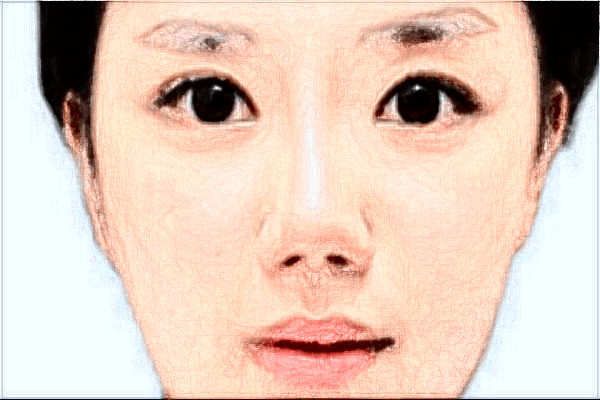 2024假體隆鼻價(jià)目表_假體隆鼻恢復(fù)期是多久