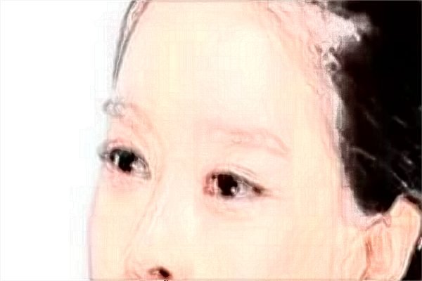 2024割雙眼皮價目表公布_割雙眼皮大概多久能恢復(fù)正常