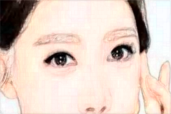 2024埋線雙眼皮價目表公布_埋線雙眼皮的危害性