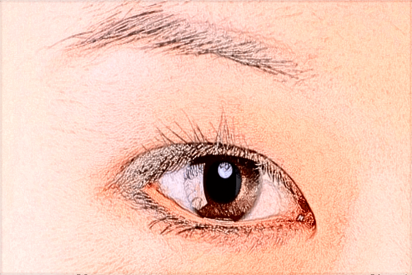 2024開眼角價(jià)目表公布_開眼角有疤痕增生怎么辦