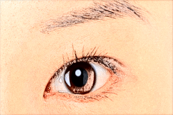 2024開眼角價(jià)目表公布_開眼角有疤痕增生怎么辦