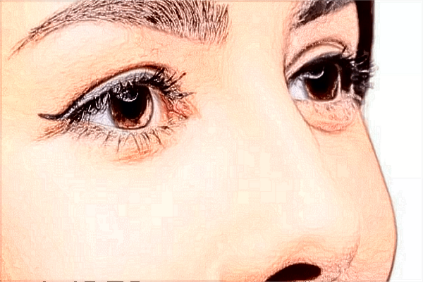 割雙眼皮有哪些危害性?割雙眼皮有什么危害或者后遺癥？