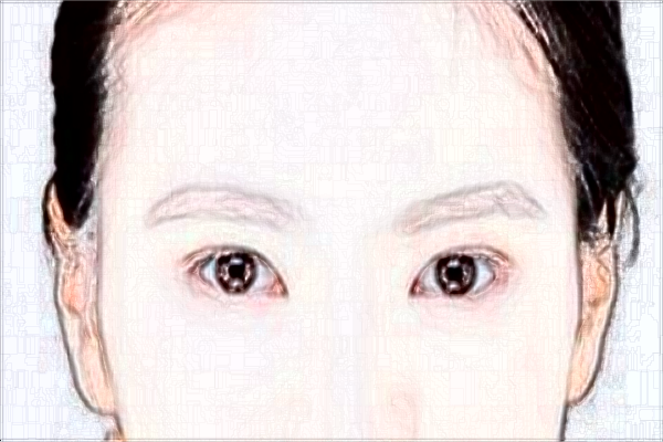 2024定點(diǎn)雙眼皮價(jià)目表公布_定點(diǎn)雙眼皮多久恢復(fù)自然