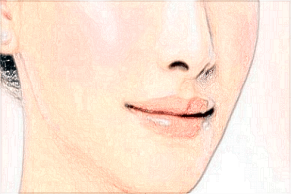 義烏玻尿酸豐唇醫(yī)院推薦_玻尿酸豐唇幾天可以恢復自然