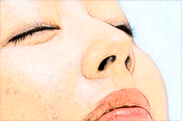 潮州華美脂肪填充怎么樣?哪個(gè)醫(yī)生好