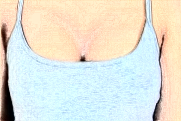 大連去副乳哪家醫(yī)院好_2024去副乳價格表公布