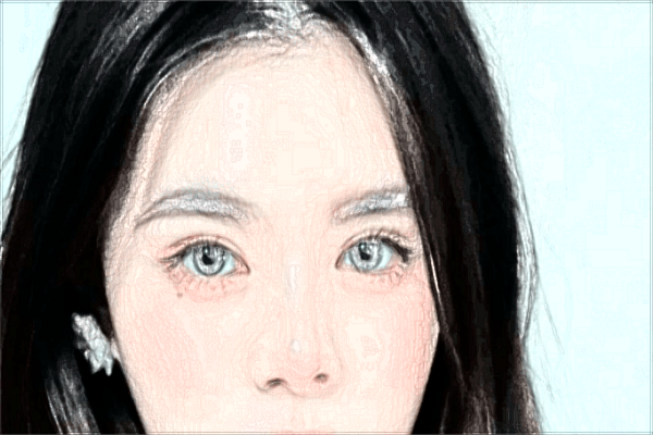 割雙眼皮會留疤痕不?割雙眼皮會導(dǎo)致視力下降嗎?