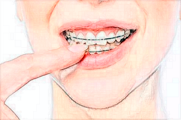 2024河南中醫(yī)大一附院做下頜角怎么樣_哪個醫(yī)生好