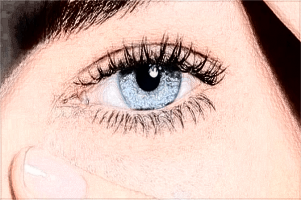 重慶市切開雙眼皮價(jià)格表_2024切開雙眼皮價(jià)格公示