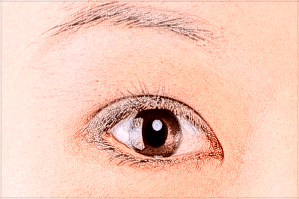 2024北京同仁醫(yī)院割雙眼皮價(jià)格表_割雙眼皮有沒有風(fēng)險(xiǎn)