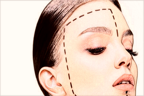 2024北京同仁醫(yī)院拉皮手術(shù)收費(fèi)價(jià)格表(價(jià)目表)一覽