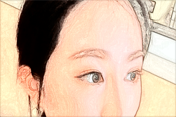 義烏內(nèi)切去眼袋怎么樣_醫(yī)院哪里好