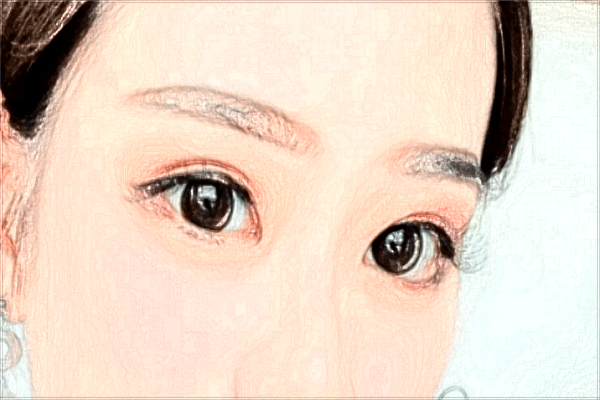 義烏去眉間紋醫(yī)院推薦_哪位醫(yī)生好