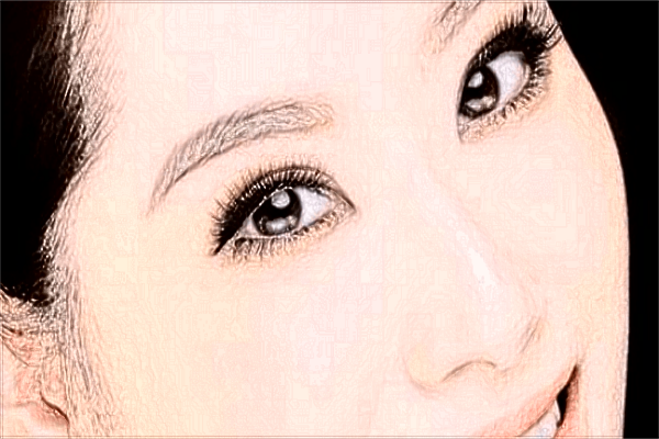 重慶聯(lián)合麗格做雙眼皮價(jià)目表【雙眼皮案例】