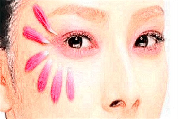 北京禾美嘉除皺項(xiàng)目怎么樣?除皺后應(yīng)該注意些什么