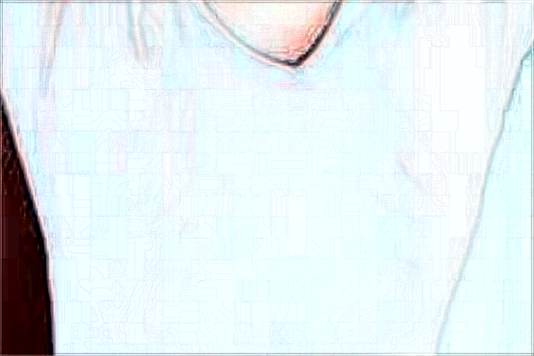 2024重慶聯(lián)合麗格徐鐸技術(shù)怎么樣【附手術(shù)案例】