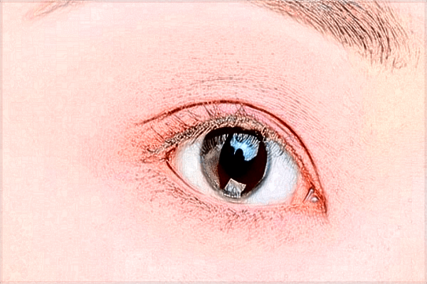 2024四川米蘭柏羽做眼袋的醫(yī)生收費價格表一覽