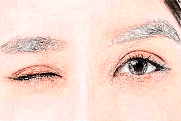 北京蒂凡妮做雙眼皮醫(yī)生價格表怎么樣