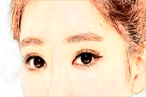 2024北京沃爾整形醫(yī)院雙眼皮價目表(價格表)怎么樣