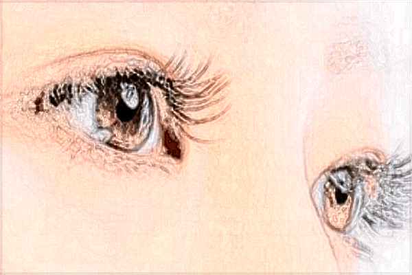 潤美玉之光自體脂肪填充好嗎_價格表一覽