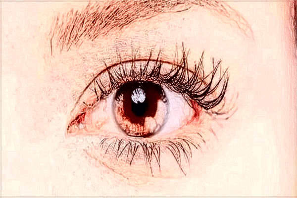 2024北京協(xié)和醫(yī)院做雙眼皮大概多少錢(qián)_附醫(yī)生名單