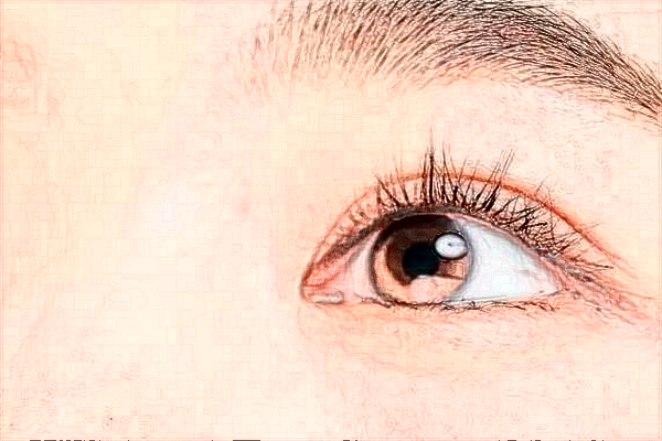 2024北京協(xié)和醫(yī)院做雙眼皮大概多少錢(qián)_附醫(yī)生名單