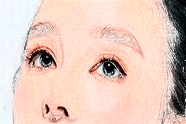 開內(nèi)眼角會(huì)留疤嗎(9月更新)_2024開內(nèi)眼角收費(fèi)價(jià)目表