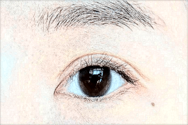 2024北京協(xié)和醫(yī)院開眼角價(jià)目表(價(jià)格表)怎么樣