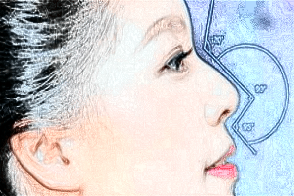 2024上海時(shí)光整形醫(yī)院假體隆鼻怎么樣_哪位醫(yī)生技術(shù)好