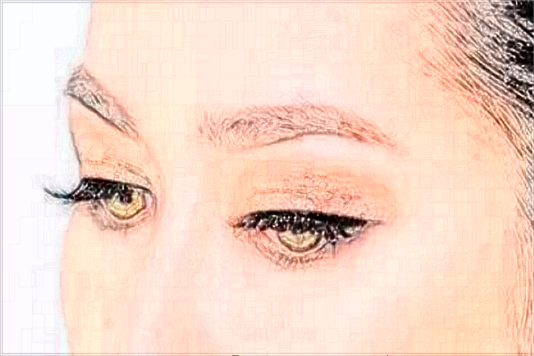 上海伊萊美做雙眼皮怎么樣_醫(yī)生推薦