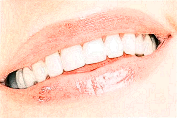 2024北京中醫(yī)醫(yī)院補牙多少錢_哪位醫(yī)生技術(shù)比較好