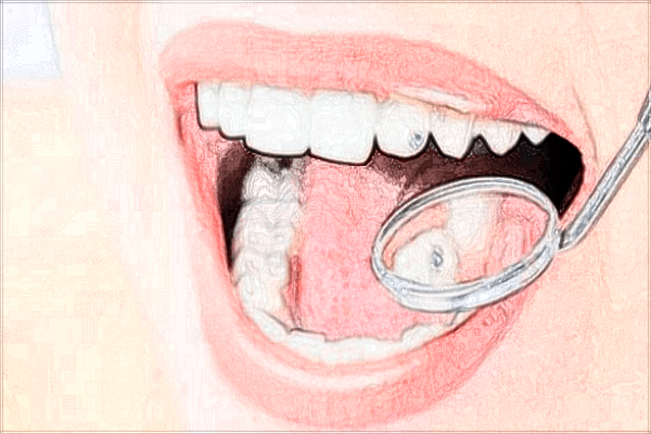 2024北京中醫(yī)醫(yī)院種植牙價(jià)目表(價(jià)格表)曝光_怎么樣