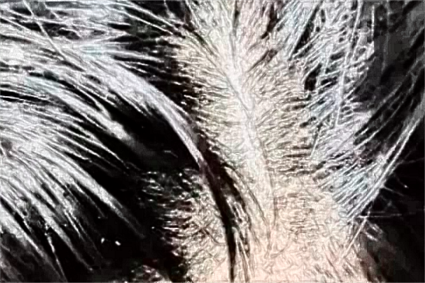 上海長(zhǎng)征醫(yī)院種發(fā)際線收費(fèi)價(jià)格_種發(fā)際線怎么樣