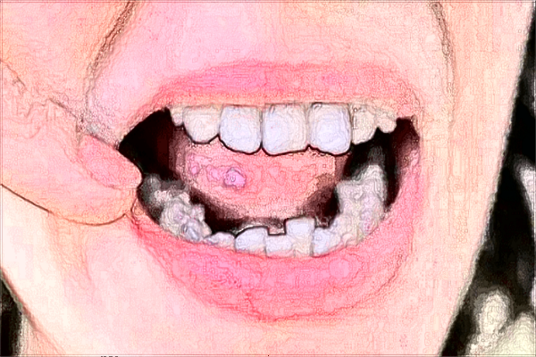 北京中醫(yī)醫(yī)院烤瓷牙補(bǔ)牙多少錢_哪位醫(yī)生技術(shù)比較好